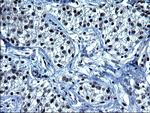 SMAD1 Antibody in Immunohistochemistry (Paraffin) (IHC (P))