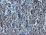 SMAD1 Antibody in Immunohistochemistry (Paraffin) (IHC (P))