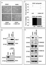 ERK1/ERK2 Antibody in Western Blot (WB)