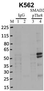 Phospho-SMAD2 (Thr8) Antibody in Immunoprecipitation (IP)