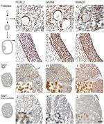 SMAD3 Antibody in Immunohistochemistry (IHC)