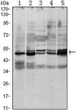 SMAD3 Antibody in Western Blot (WB)