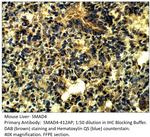 Smad4 Antibody in Immunohistochemistry (IHC)