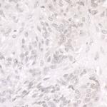 SMARCA1/SNF2L Antibody in Immunohistochemistry (IHC)