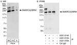 SMARCA2/BRM Antibody in Western Blot (WB)