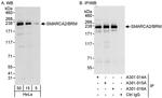 SMARCA2/BRM Antibody in Western Blot (WB)