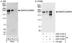 SMARCA2/BRM Antibody in Western Blot (WB)