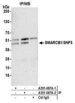 SMARCB1/SNF5 Antibody in Western Blot (WB)