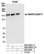 SMARCC2/BAF170 Antibody in Western Blot (WB)