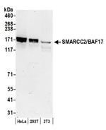 SMARCC2/BAF170 Antibody in Western Blot (WB)