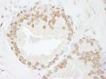 SMARCC2/BAF170 Antibody in Immunohistochemistry (IHC)