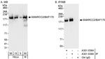 SMARCC2/BAF170 Antibody in Western Blot (WB)