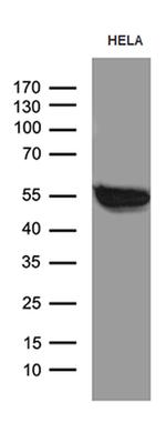 SMARCD3 Antibody in Western Blot (WB)