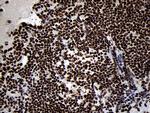 SMC1A Antibody in Immunohistochemistry (Paraffin) (IHC (P))