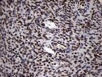 SMC1A Antibody in Immunohistochemistry (Paraffin) (IHC (P))