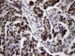 SMC1A Antibody in Immunohistochemistry (Paraffin) (IHC (P))