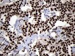 SMC1A Antibody in Immunohistochemistry (Paraffin) (IHC (P))