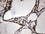 SMC1A Antibody in Immunohistochemistry (Paraffin) (IHC (P))