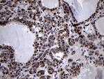 SMC1A Antibody in Immunohistochemistry (Paraffin) (IHC (P))