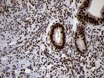 SMC1A Antibody in Immunohistochemistry (Paraffin) (IHC (P))