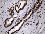 SMC1A Antibody in Immunohistochemistry (Paraffin) (IHC (P))