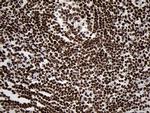 SMC1A Antibody in Immunohistochemistry (Paraffin) (IHC (P))