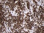 SMC1A Antibody in Immunohistochemistry (Paraffin) (IHC (P))