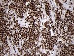 SMC1A Antibody in Immunohistochemistry (Paraffin) (IHC (P))