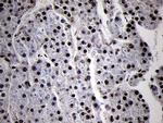 SMC1A Antibody in Immunohistochemistry (Paraffin) (IHC (P))