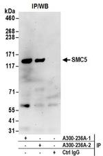 SMC5 Antibody in Western Blot (WB)