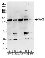 SMC5 Antibody in Western Blot (WB)