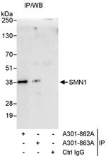 SMN1 Antibody in Immunoprecipitation (IP)