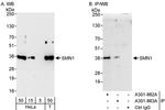 SMN1 Antibody in Western Blot (WB)