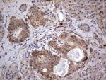 SMPD1 Antibody in Immunohistochemistry (Paraffin) (IHC (P))