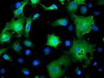 SMS Antibody in Immunocytochemistry (ICC/IF)