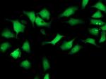 SMS Antibody in Immunocytochemistry (ICC/IF)