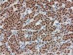 SMS Antibody in Immunohistochemistry (Paraffin) (IHC (P))