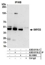 SMYD2 Antibody in Western Blot (WB)