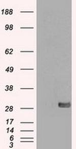 SNAI1 Antibody in Western Blot (WB)