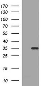 SNAI1 Antibody in Western Blot (WB)