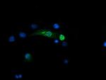 SNAI2 Antibody in Immunocytochemistry (ICC/IF)