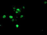 SNAI2 Antibody in Immunocytochemistry (ICC/IF)