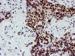 SNAI2 Antibody in Immunohistochemistry (Paraffin) (IHC (P))