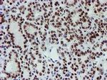 SNAI2 Antibody in Immunohistochemistry (Paraffin) (IHC (P))