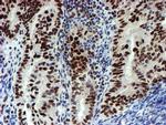 SNAI2 Antibody in Immunohistochemistry (Paraffin) (IHC (P))