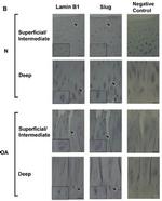 SNAI2 Antibody in Immunohistochemistry (Paraffin) (IHC (P))