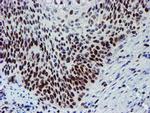 SNAI2 Antibody in Immunohistochemistry (Paraffin) (IHC (P))