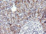 SNAI2 Antibody in Immunohistochemistry (Paraffin) (IHC (P))