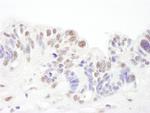 SNRPA1 Antibody in Immunohistochemistry (IHC)