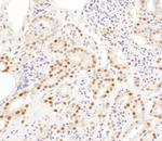 SNRPA1 Antibody in Immunohistochemistry (IHC)